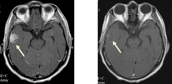 ts20220324-1.jpg ts20220324-1.jpg