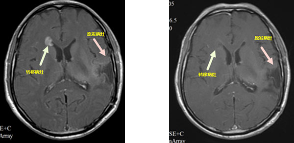 ts20220324-2.jpg ts20220324-2.jpg