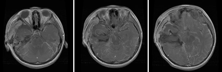 ts20220324-3.jpg ts20220324-3.jpg