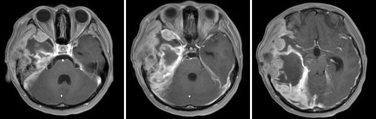 ts20220324-5.jpg ts20220324-5.jpg