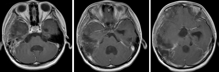 ts20220324-6.jpg ts20220324-6.jpg