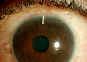 青光眼亚专科-7.jpg 青光眼亚专科-7.jpg