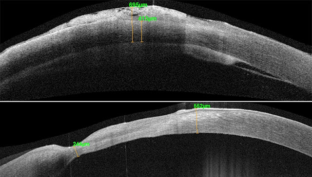 眼表及角膜-1.jpg 眼表及角膜-1.jpg