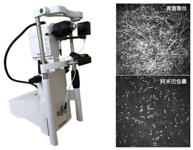 眼表及角膜-2.jpg 眼表及角膜-2.jpg