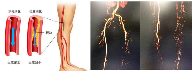 xg-t31.jpg xg-t31.jpg