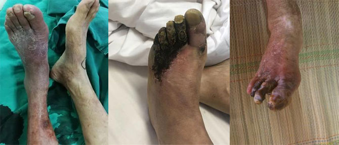 xg-t32.jpg xg-t32.jpg