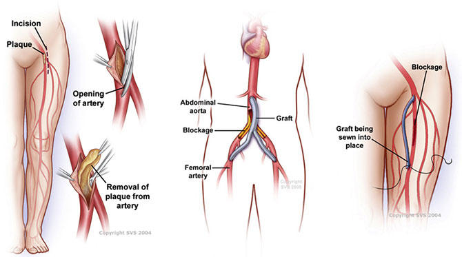 xg-t33.jpg xg-t33.jpg