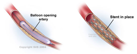 xg-t35.jpg xg-t35.jpg