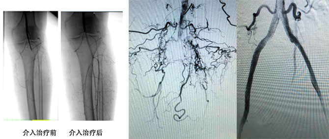 xg-t36.jpg xg-t36.jpg