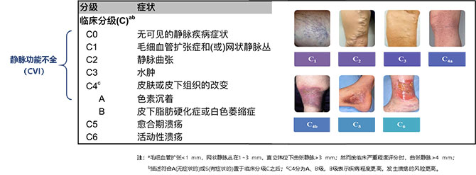 xg-t41.jpg xg-t41.jpg