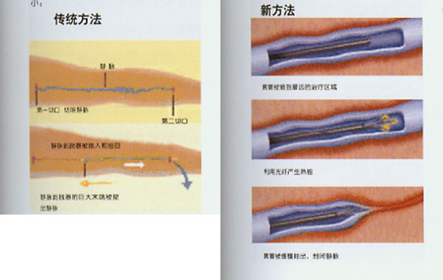 xg-t43.jpg xg-t43.jpg