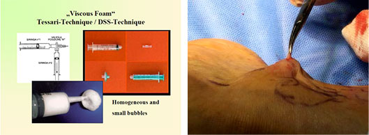 xg-t44.jpg xg-t44.jpg