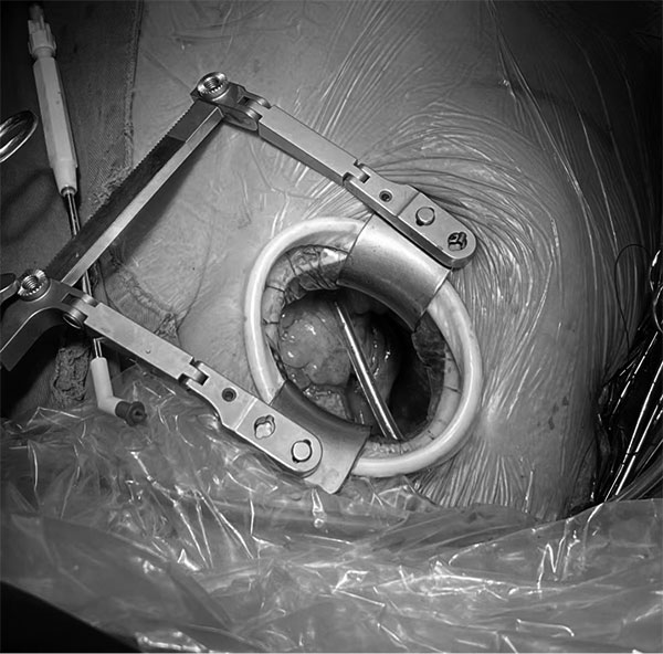 640-(2).jpg 640-(2).jpg