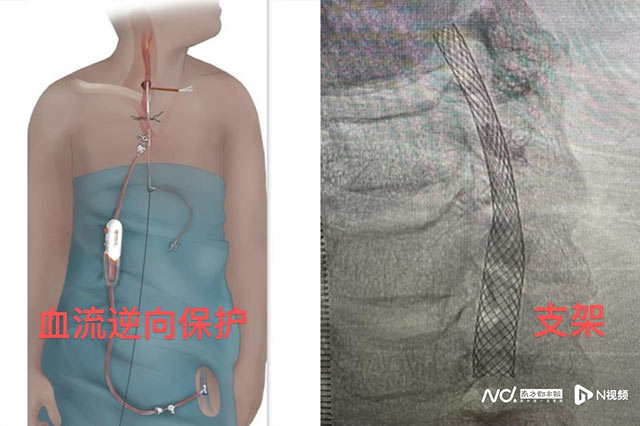 mt0617-2.jpg mt0617-2.jpg