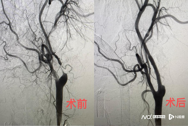 mt0617-1.jpg mt0617-1.jpg