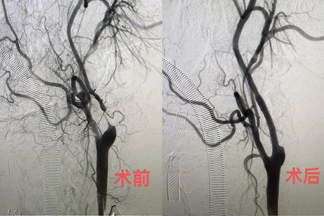 mt0617-3.jpg mt0617-3.jpg