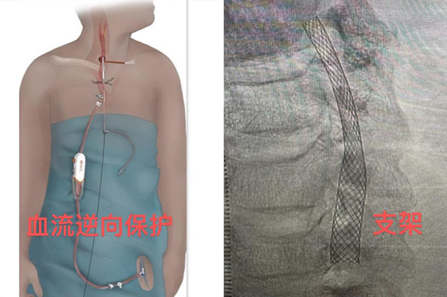 mt0617-4.jpg mt0617-4.jpg