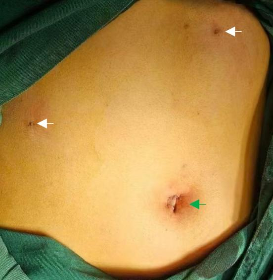 mt0613-3.png mt0613-3.png