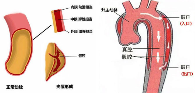 xg-t11.jpg xg-t11.jpg