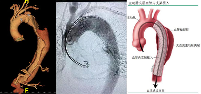 xg-t13.jpg xg-t13.jpg