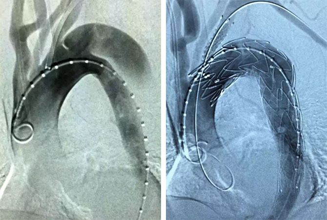 xg-t14.jpg xg-t14.jpg