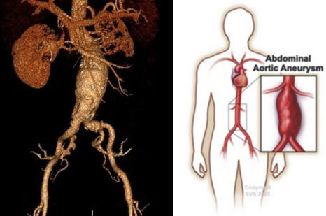 xg-t15.jpg xg-t15.jpg