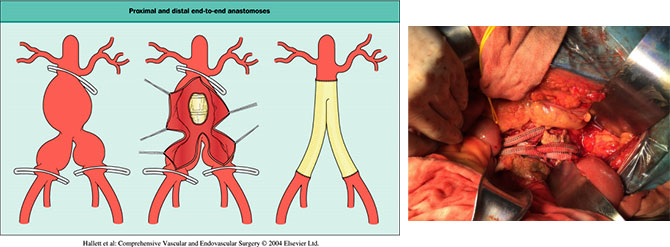 xg-t16.jpg xg-t16.jpg