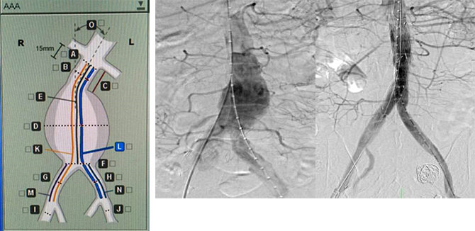 xg-t17.jpg xg-t17.jpg