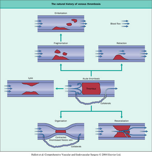xg-t51.jpg xg-t51.jpg