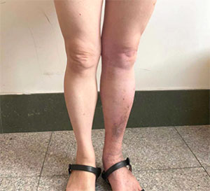 xg-t54.jpg xg-t54.jpg