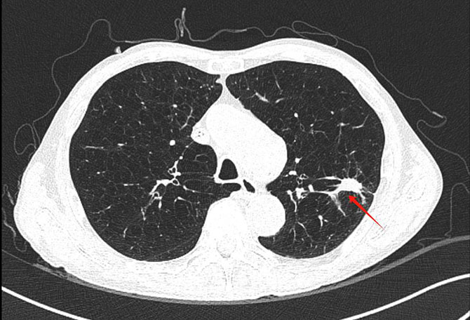 20250423-1.jpg 20250423-1.jpg