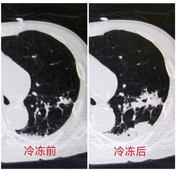 20250423-3.jpg 20250423-3.jpg