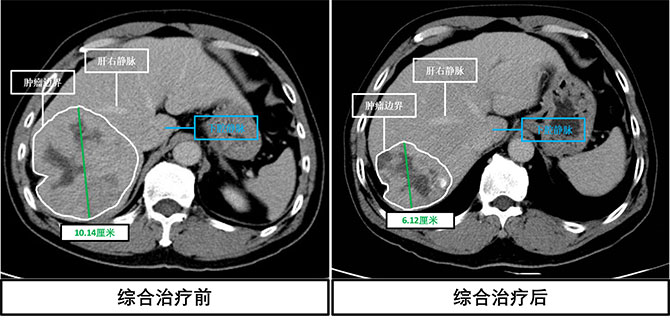 20250624-9.jpg 20250624-9.jpg