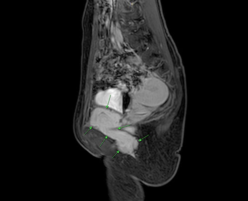 20250626-5.jpg 20250626-5.jpg