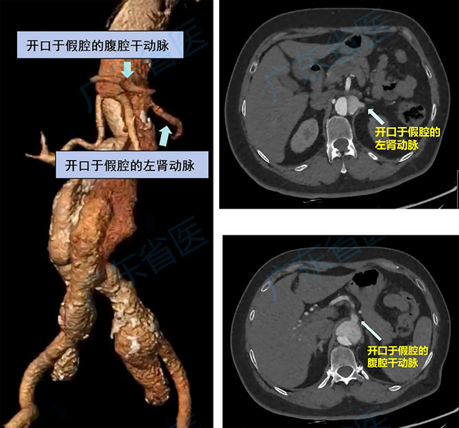 20250805-1.jpg 20250805-1.jpg