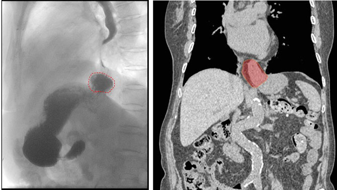 20260316-1.jpg 20260316-1.jpg