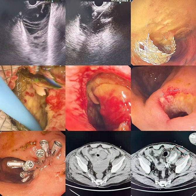 20260330-3.jpg 20260330-3.jpg